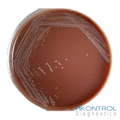 Agar chocolate en placa lista para usar – medio de cultivo Akontrol