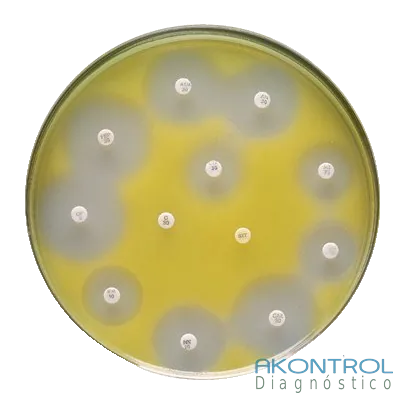 Agar Mueller-Hinton en placa lista para usar para antibiograma – Akontrol