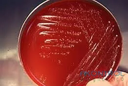 Agar sangre de cordero en placa lista para usar – medio de cultivo Akontrol