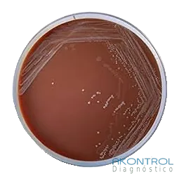 Agar Thayer Martin en placa lista para usar – medio de cultivo Akontrol