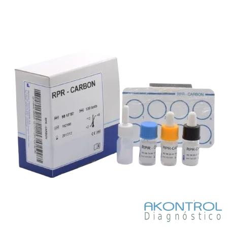 RPR CARBÓN – imagen 2 de 2